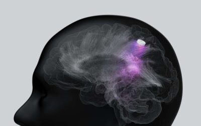 Peut-on vivre longtemps avec une tumeur au cerveau ?