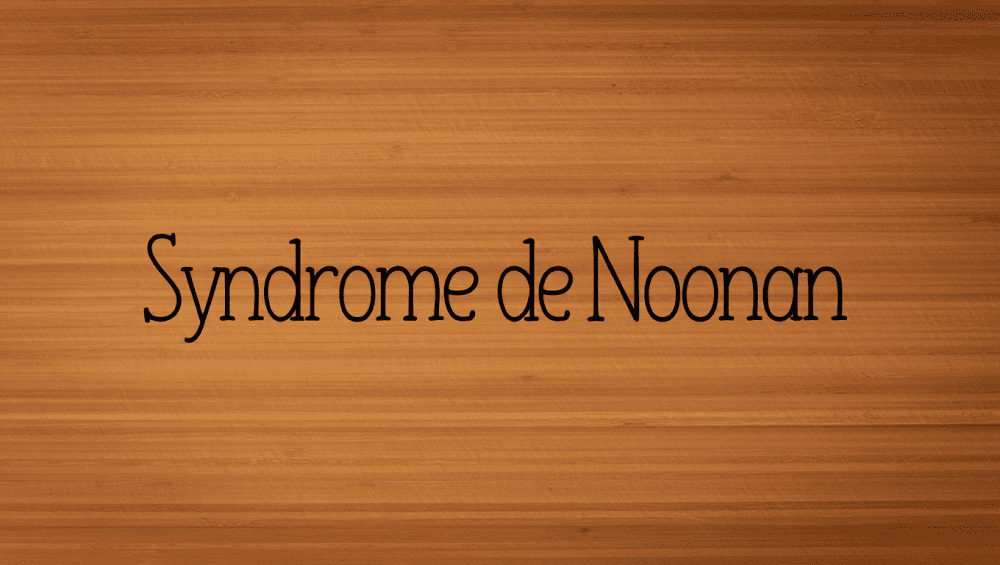 Syndrome de Noonan espérance de vie