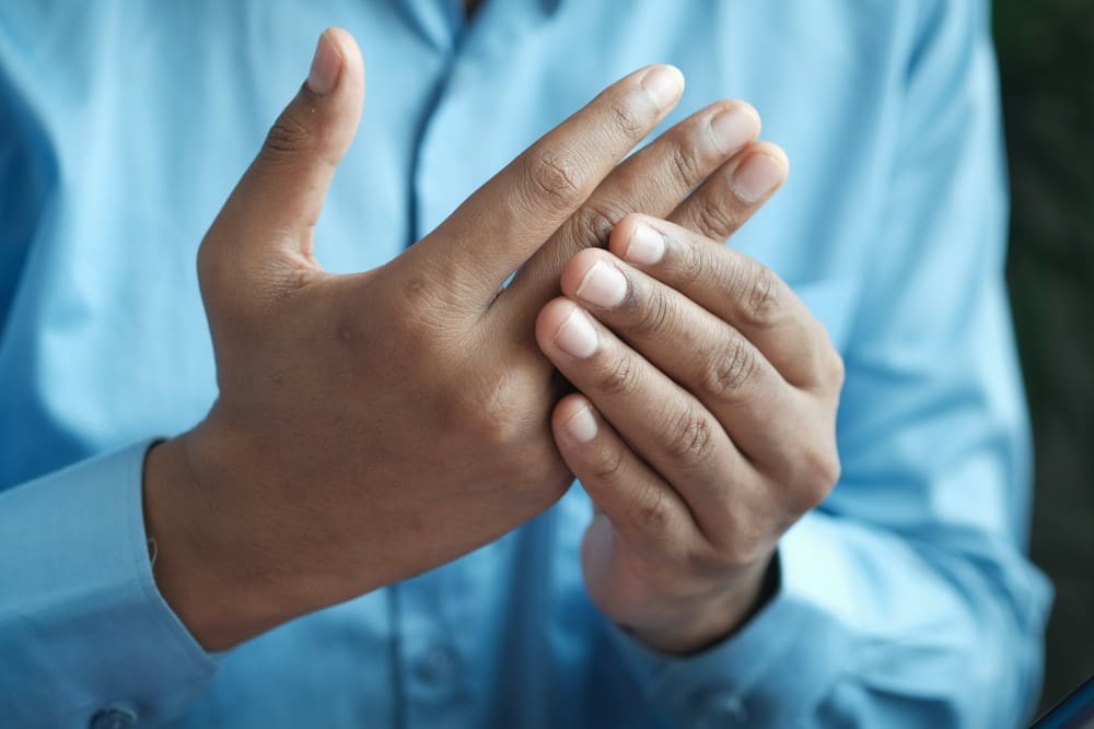 Homme ayant des douleurs aux mains, syndrome de Reiter